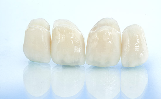 实时榜单：2023南京种植牙医院排名一览_从种植牙到戴上牙冠分几步完成(图1)