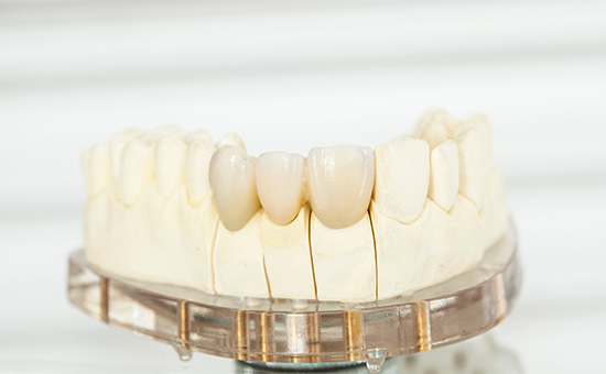 实时榜单：2023南京种植牙医院排名一览_从种植牙到戴上牙冠分几步完成(图3)